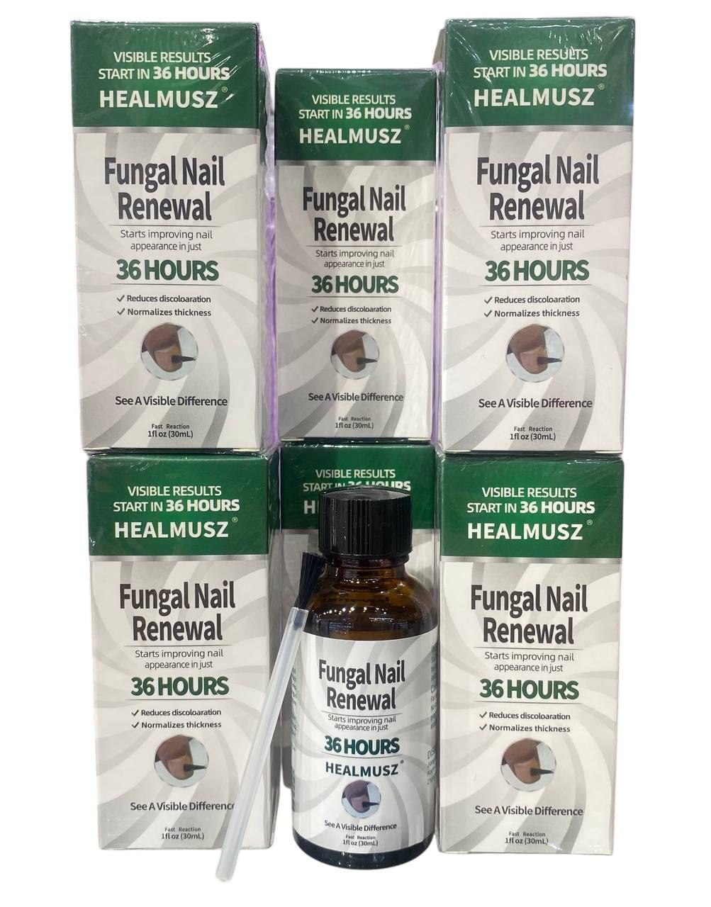 FungiNail™ – Elimina los hongos y deja uñas limpias y saludables.